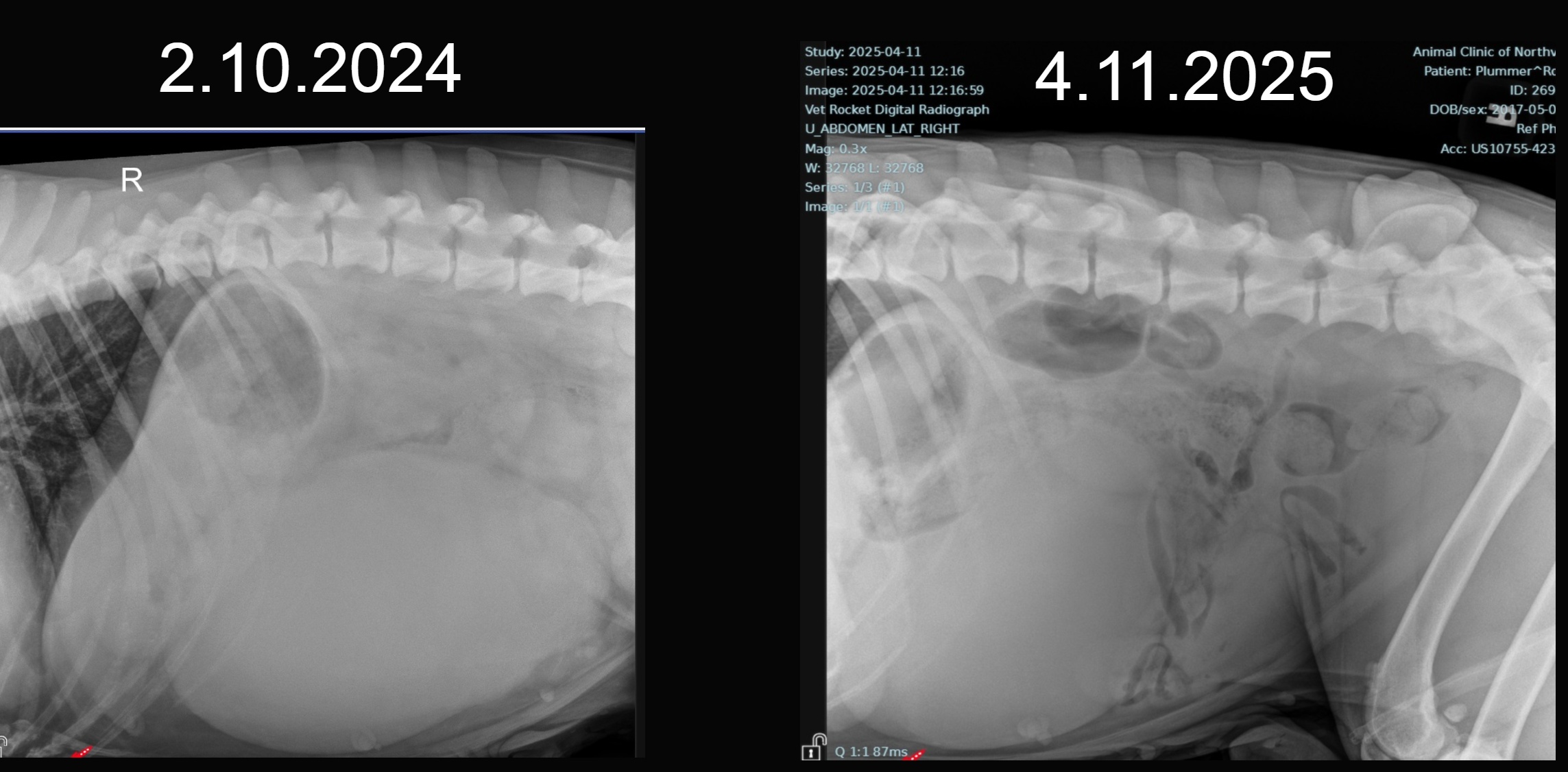 Tumor scan image